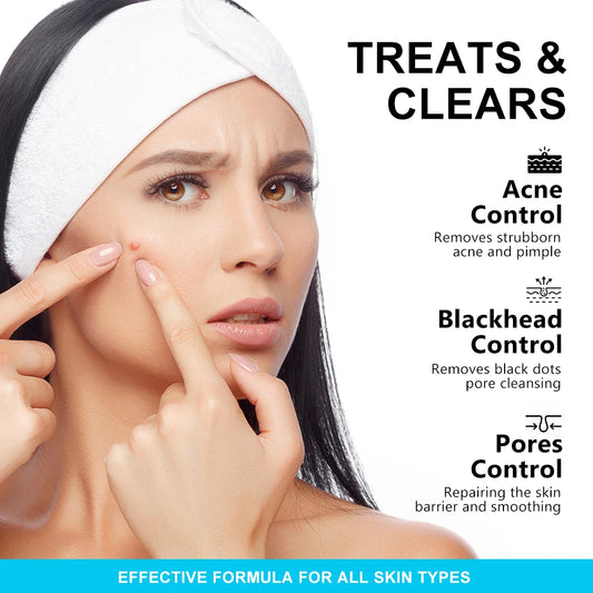 Salicylic Acid 2% Acne Treatment Cream - with Niacinamide for Pore Cleaning, Blackhead Removal & Oil Control