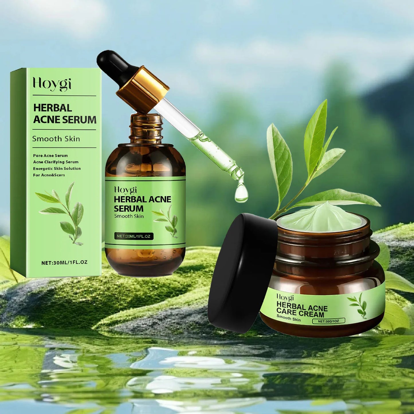 Acne Treatment Kit - Face Cream & Serum for Pimples, Oil Control, Blackheads & Pore Minimizing