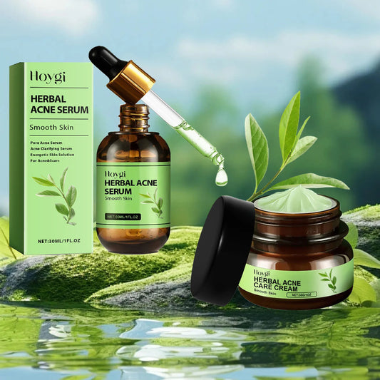 Acne Treatment Kit - Face Cream & Serum for Pimples, Oil Control, Blackheads & Pore Minimizing