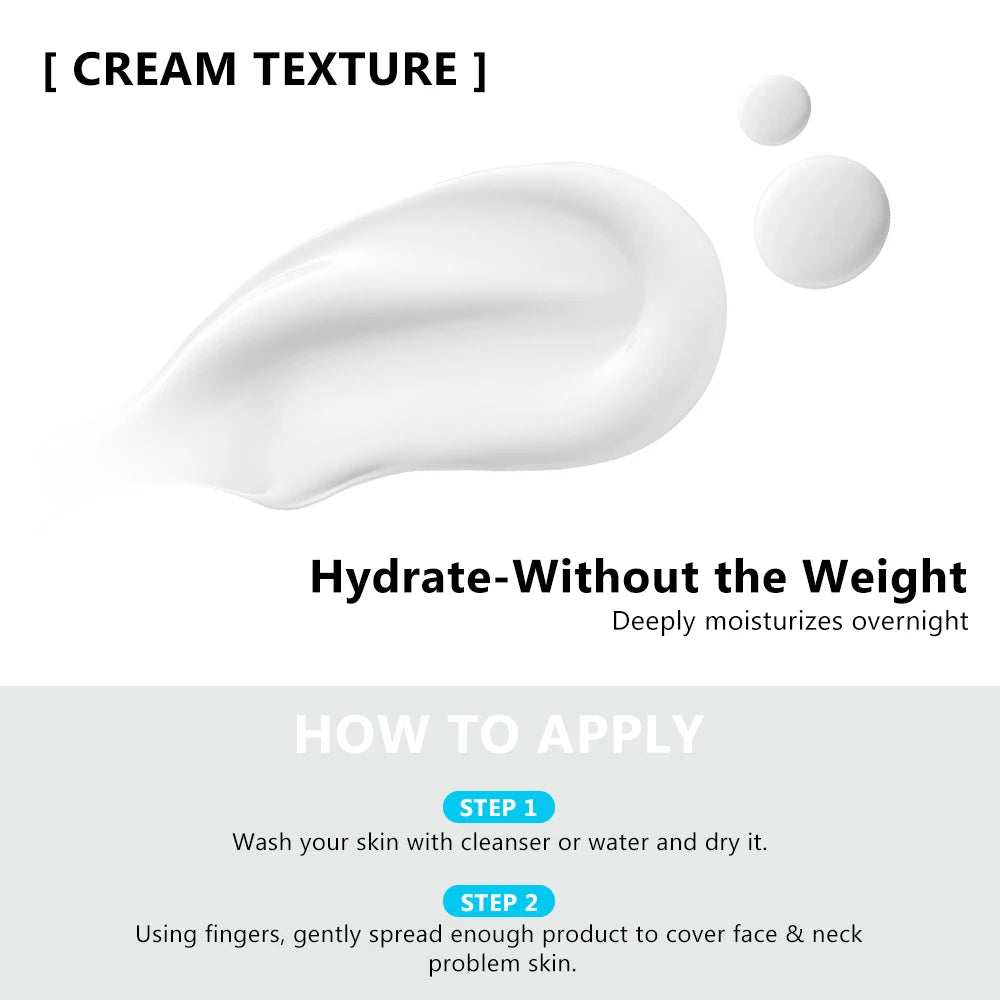 Salicylic Acid 2% Acne Treatment Cream - with Niacinamide for Pore Cleaning, Blackhead Removal & Oil Control